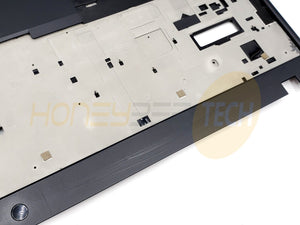 GENUINE LENOVO THINKPAD L15 G1 LAPTOP PALMREST COVER 5CB0S95384 GRADE C - Honeybee-Technologies
